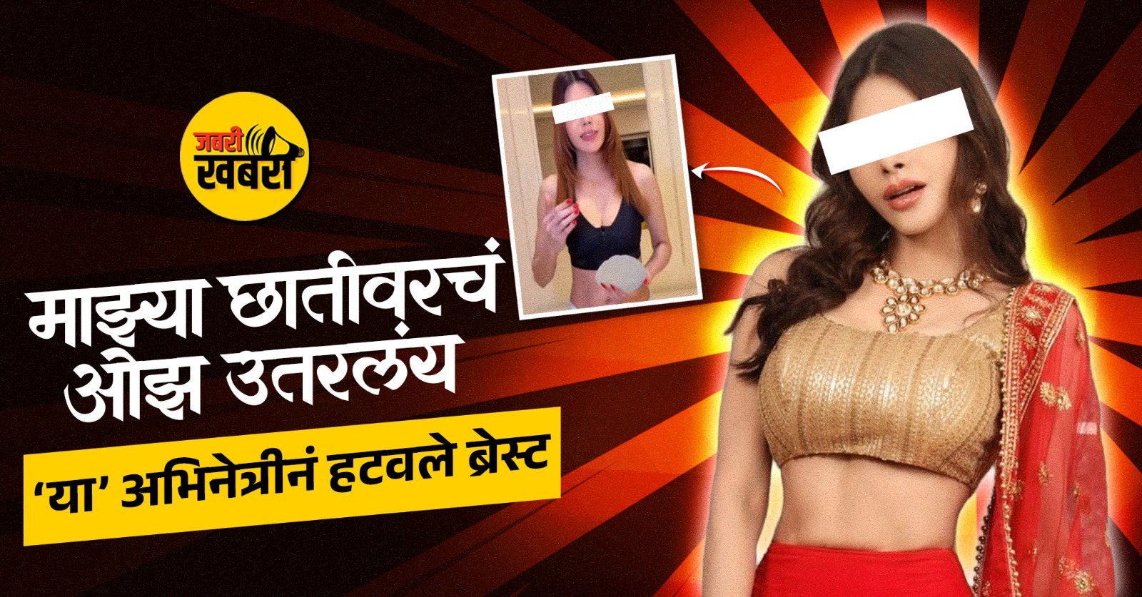 Sherlyn Chopra cosmetic surgery.